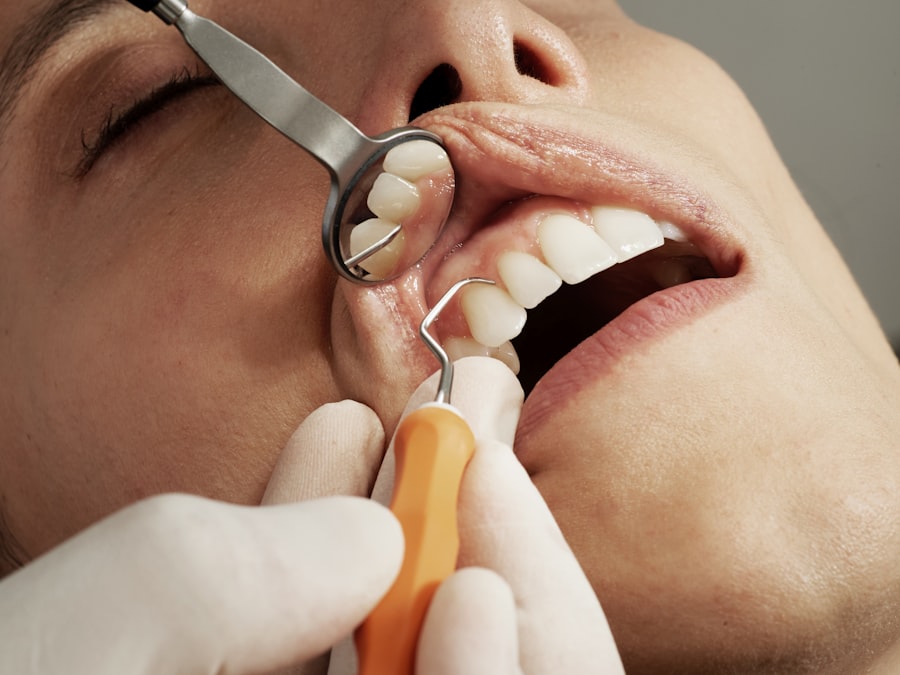 Smile Care — Al-SHIFA Dental Clinic